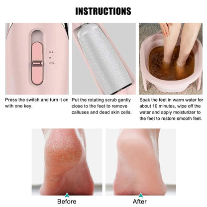 Digital Callus Remover (مزيل مسامير القدم الرقمي)